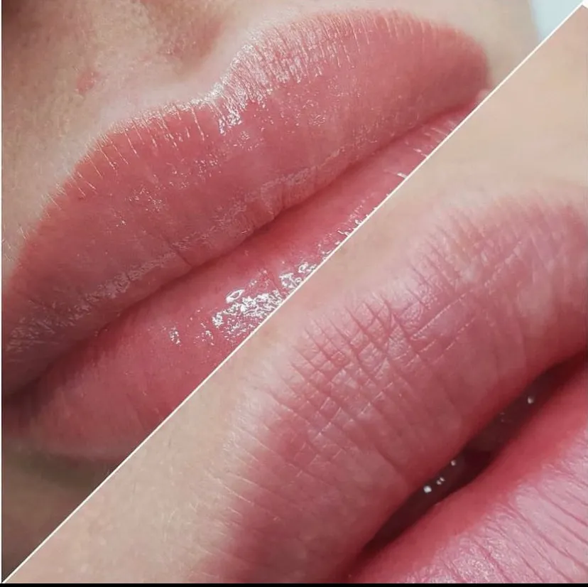 Lippenpigmentierung, natürliche Lippenfarbe, Lex Lines