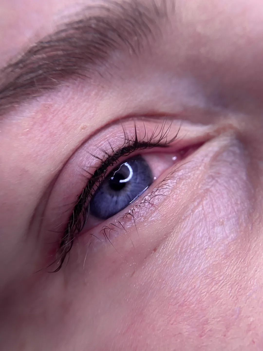 Wimpernkranzverdichtung Ergebnis, Studio Lex Lines
