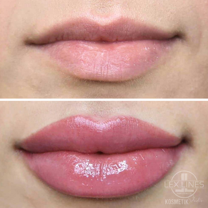 Lippenpigmentierung