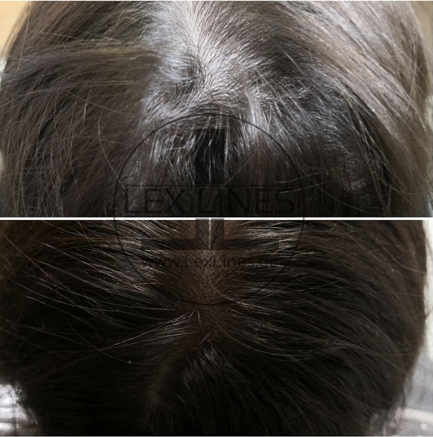 Haarpigmentierung Stuttgart