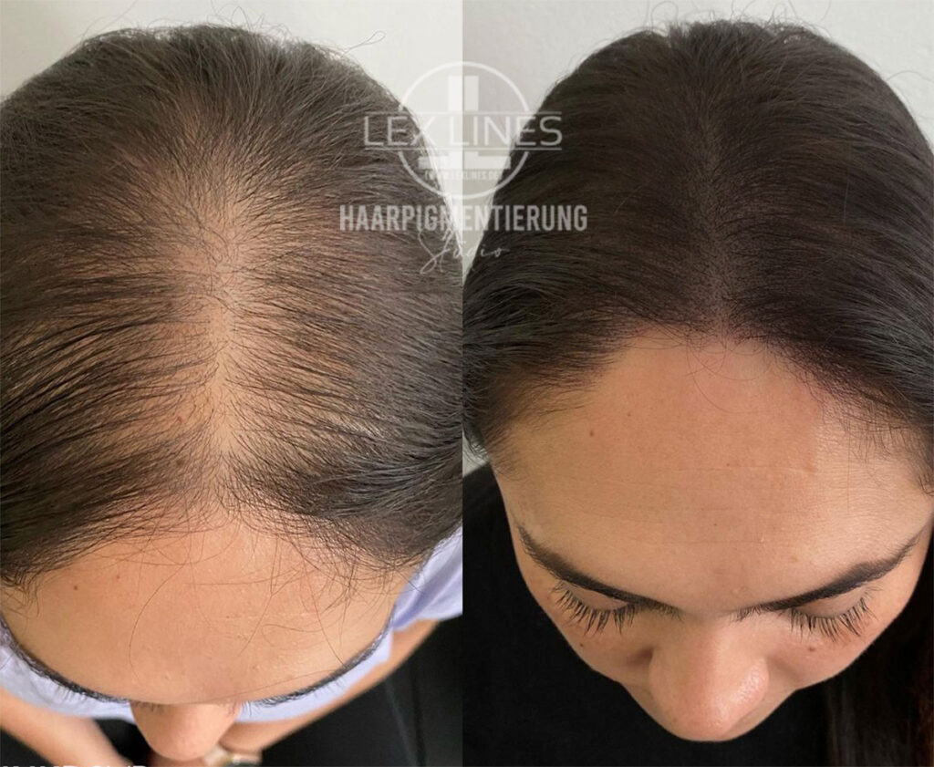Haarpigmentierung neu