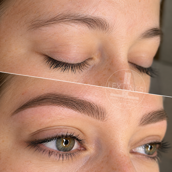 Brow3